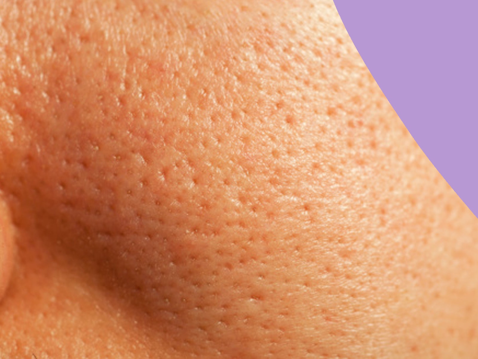 How to get rid of pores, according to the experts