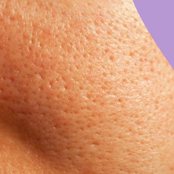 Clogged pores? This is exactly how to treat them, plus the best formulas to try