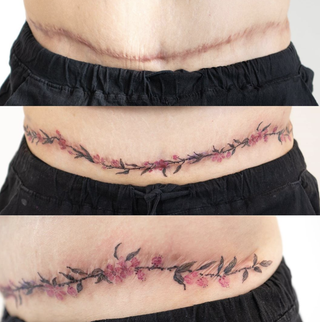 Cherry Blossom Garland scar tattoo